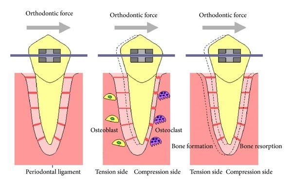 know your teeth moving