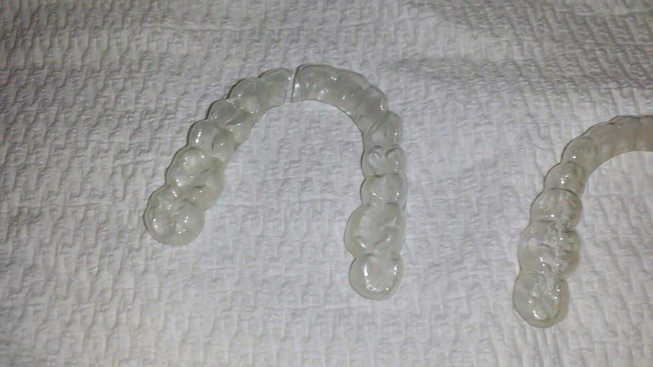 My Invisalign is Cracking! What Should I Do?