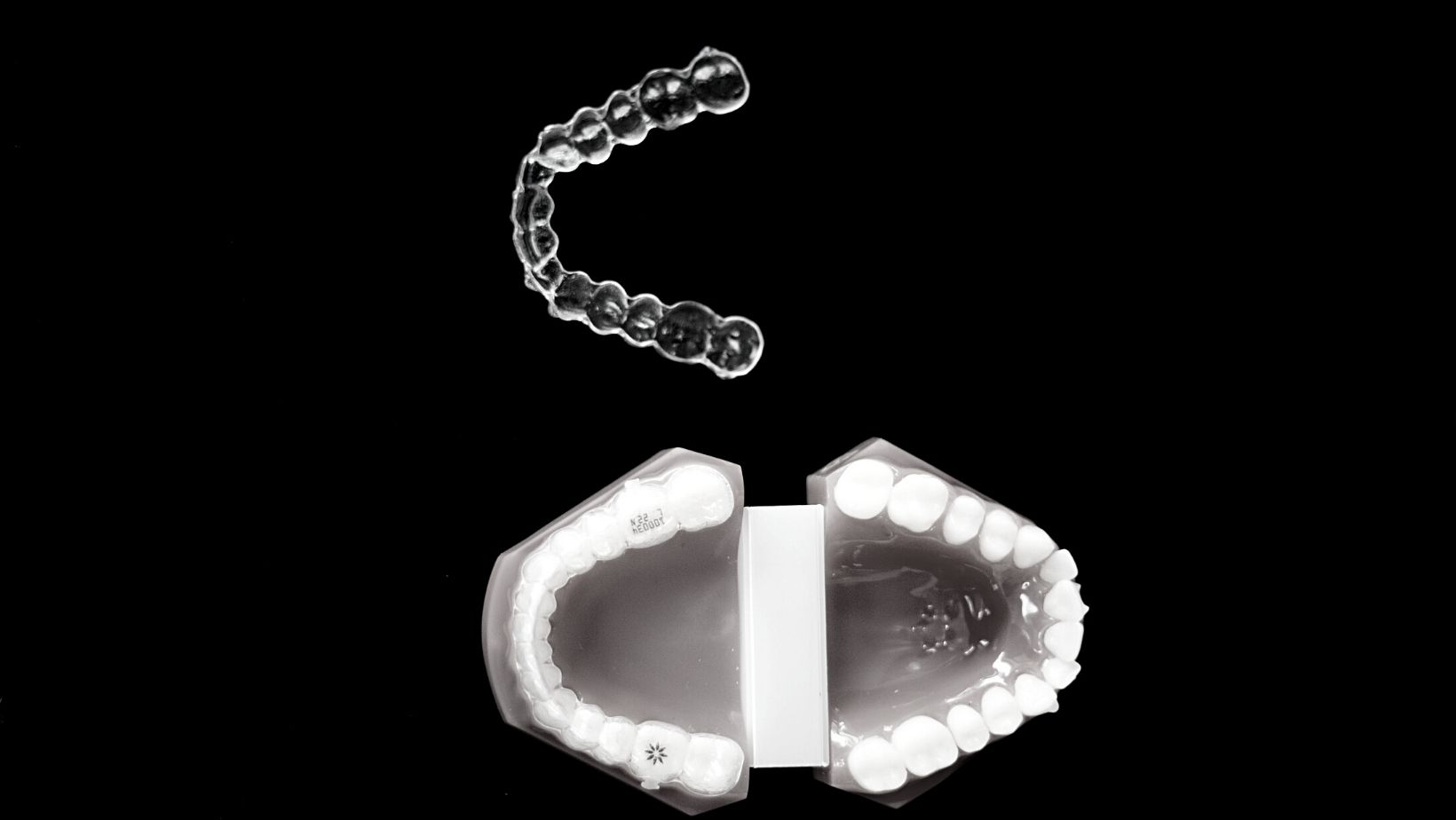 What are Invisalign Attachments? Why Are They Needed?