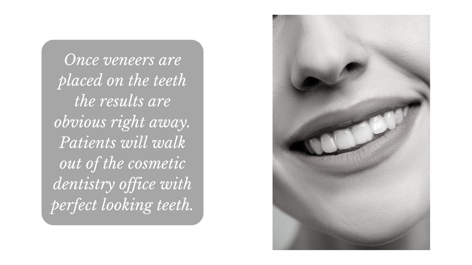Veneers on front teeth of patient