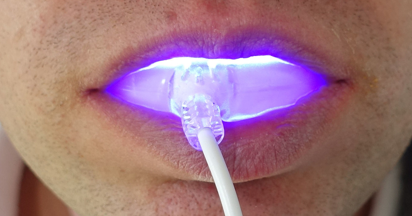 How to Use UV Light for Teeth Whitening Cosmetic Surgery Tips