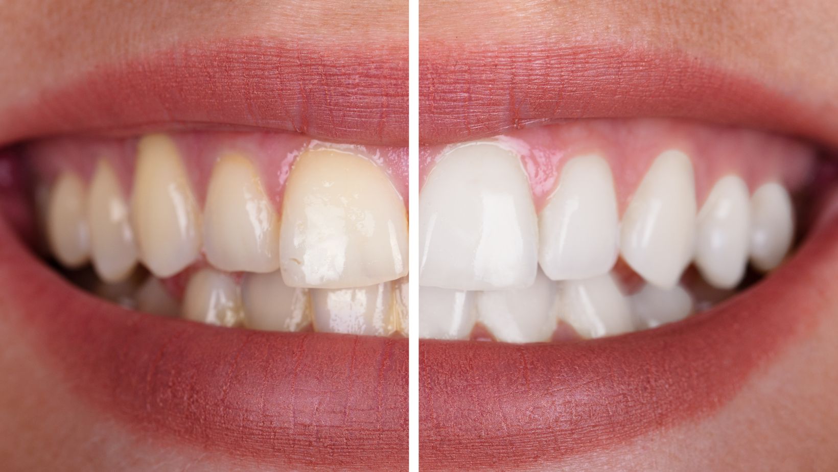 deep-teeth-cleaning-before-and-after-dental-health-society