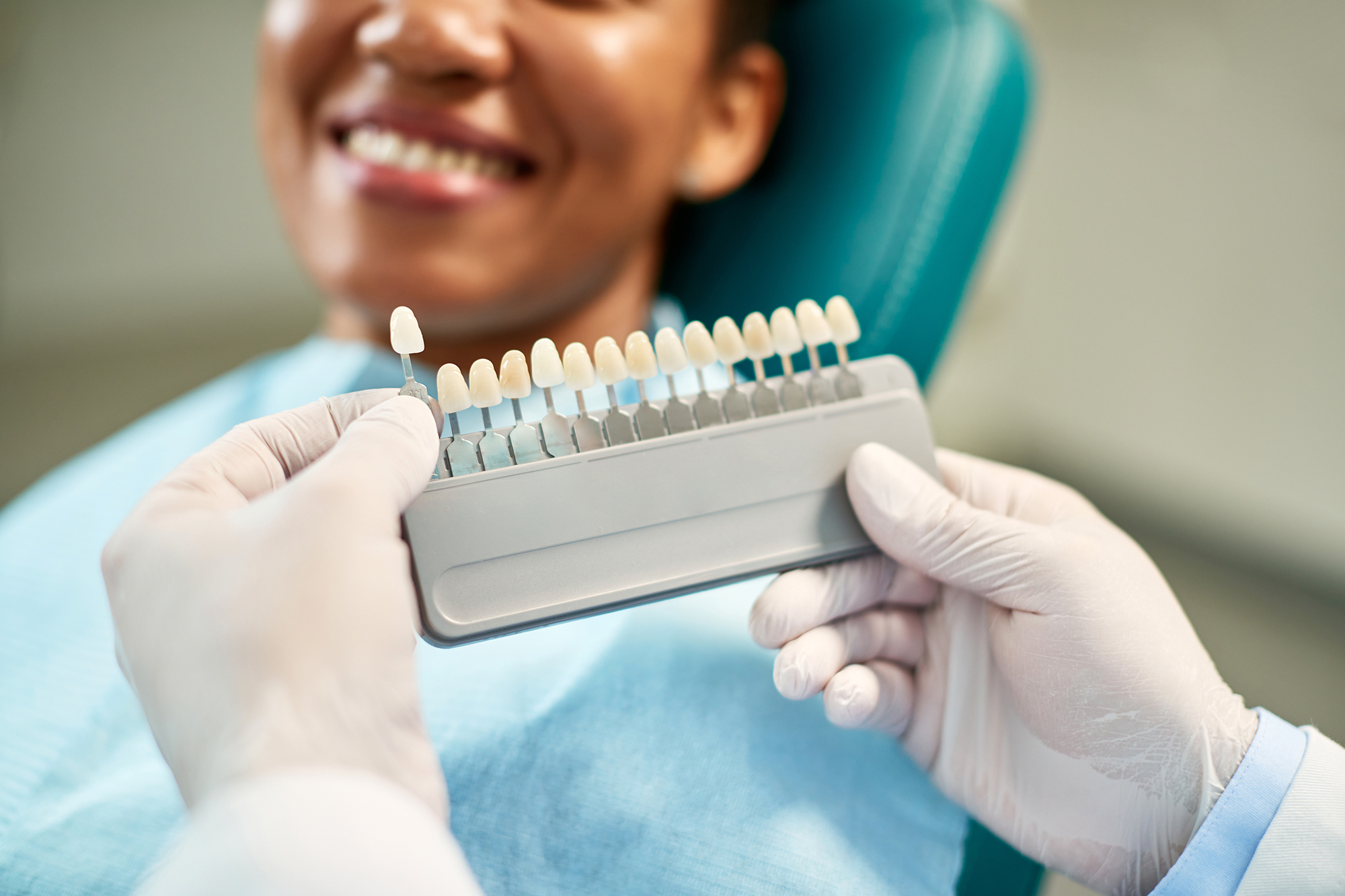 Modern Crown Materials: Porcelain-Fused-to-Zirconia vs. Monolithic Zirconia