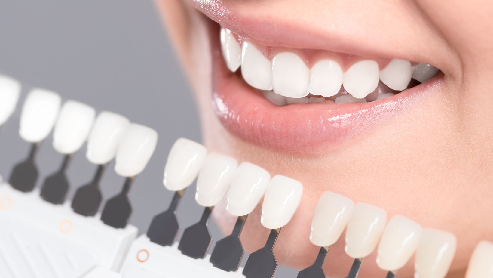 The Top 5 States Where Teeth Whitening is Most Popular