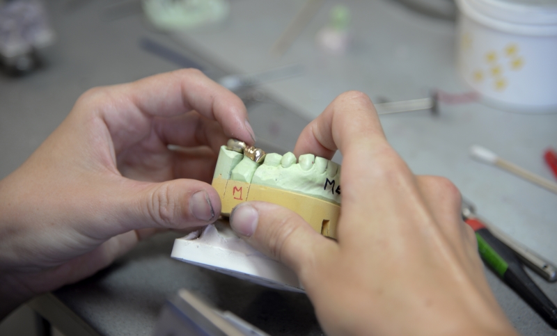 crowns in lab dental crowns safe