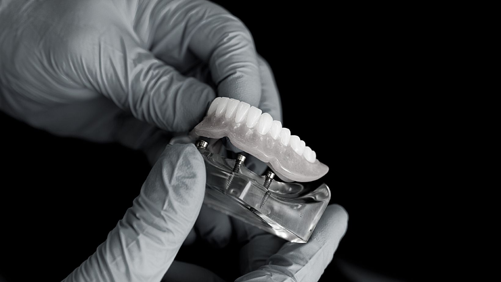 Dental Implants vs. Dentures: Costs, Advantages, and Key Differences