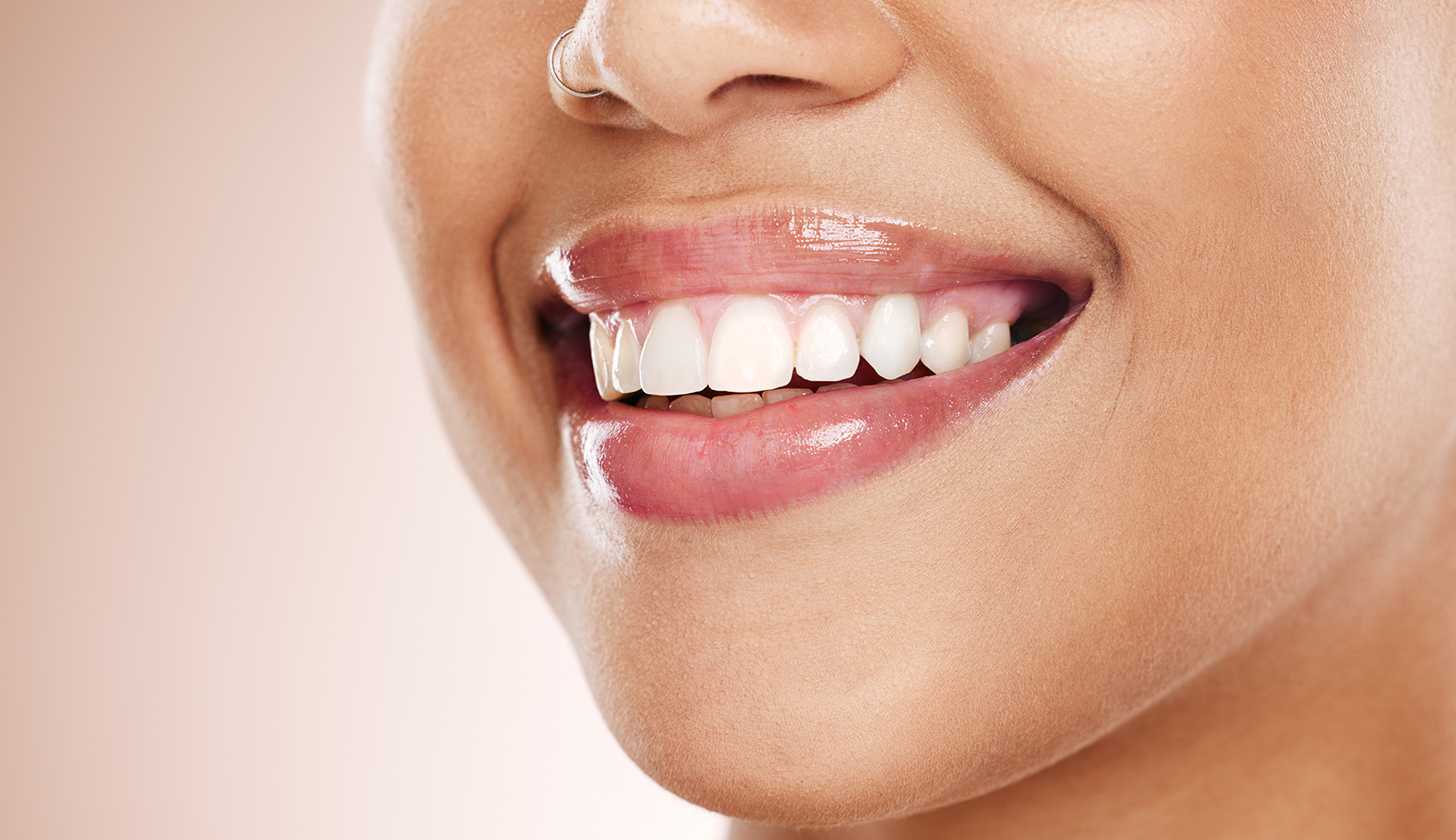 Teeth Whitening for Sensitive Teeth: Is It Possible?