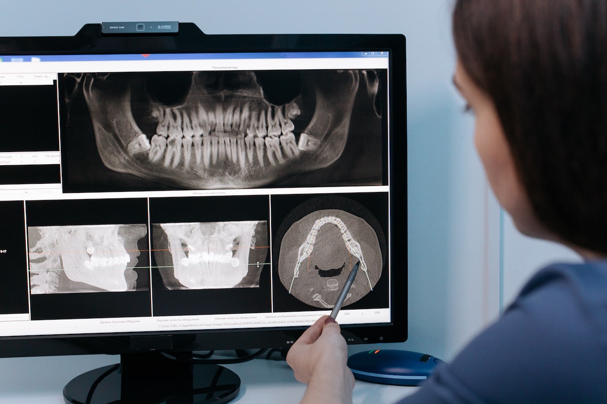 Are Dental XRays Safe? Dental Health Society