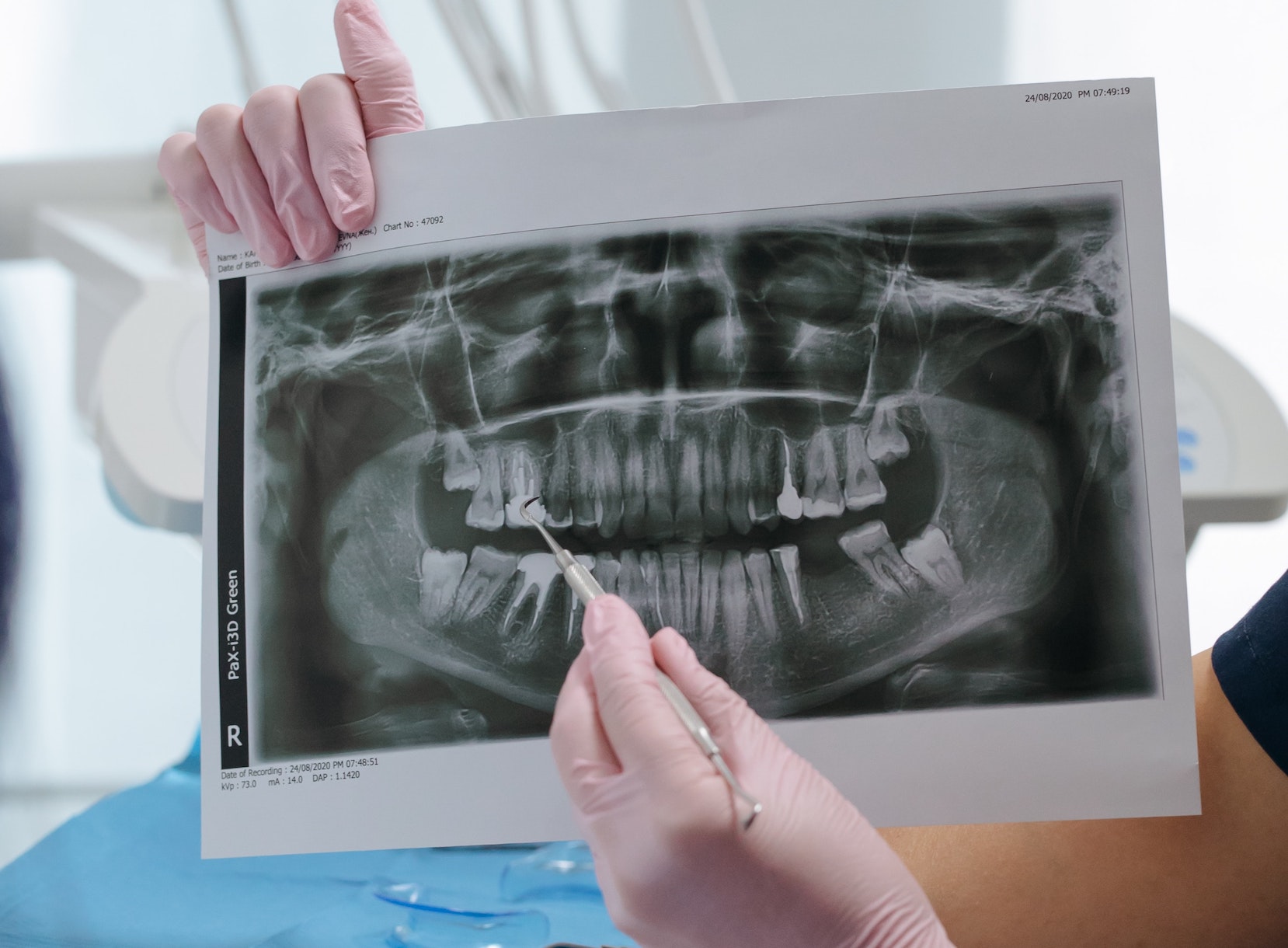 ☢️ FMX Dental X-ray Guide (Are They Safe?)