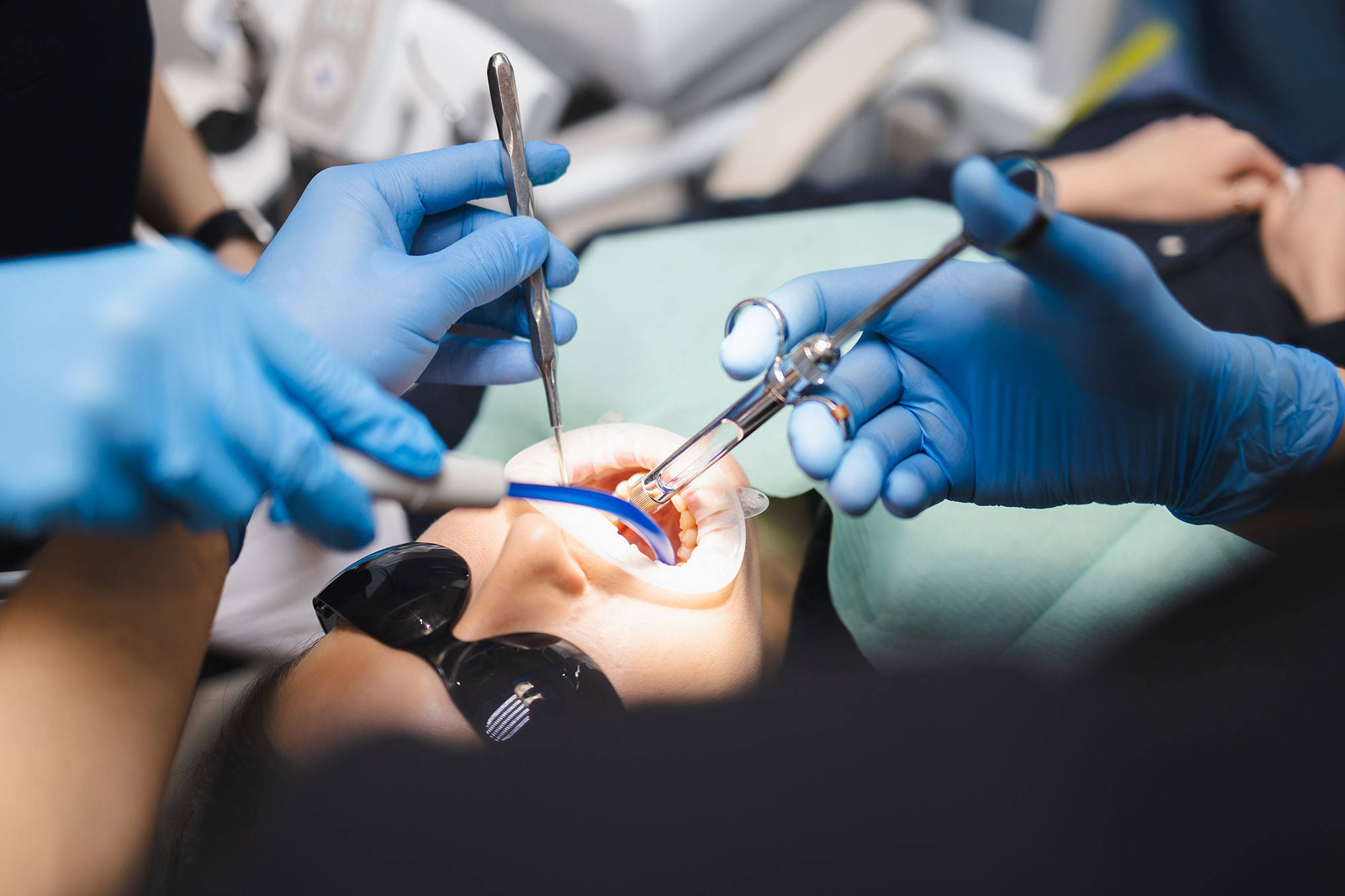 Pulp Capping vs. Root Canal: Saving the Nerve When Decay Is Close