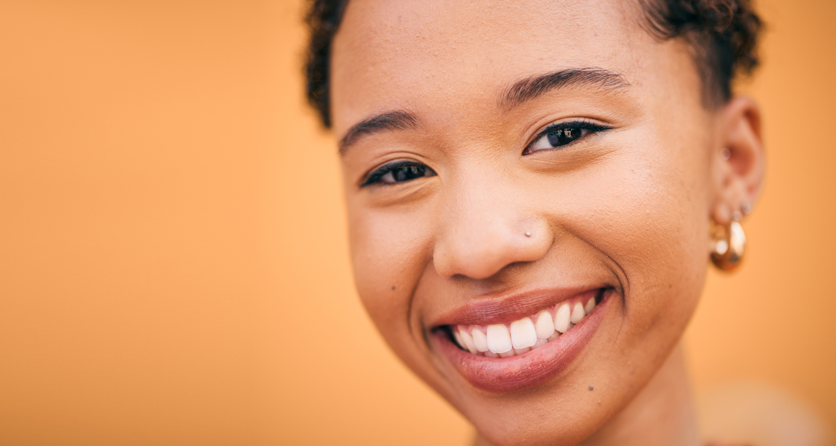 Snap-On Smile vs. Permanent Veneers: A Temporary Fix or a Long-Term Smile Solution