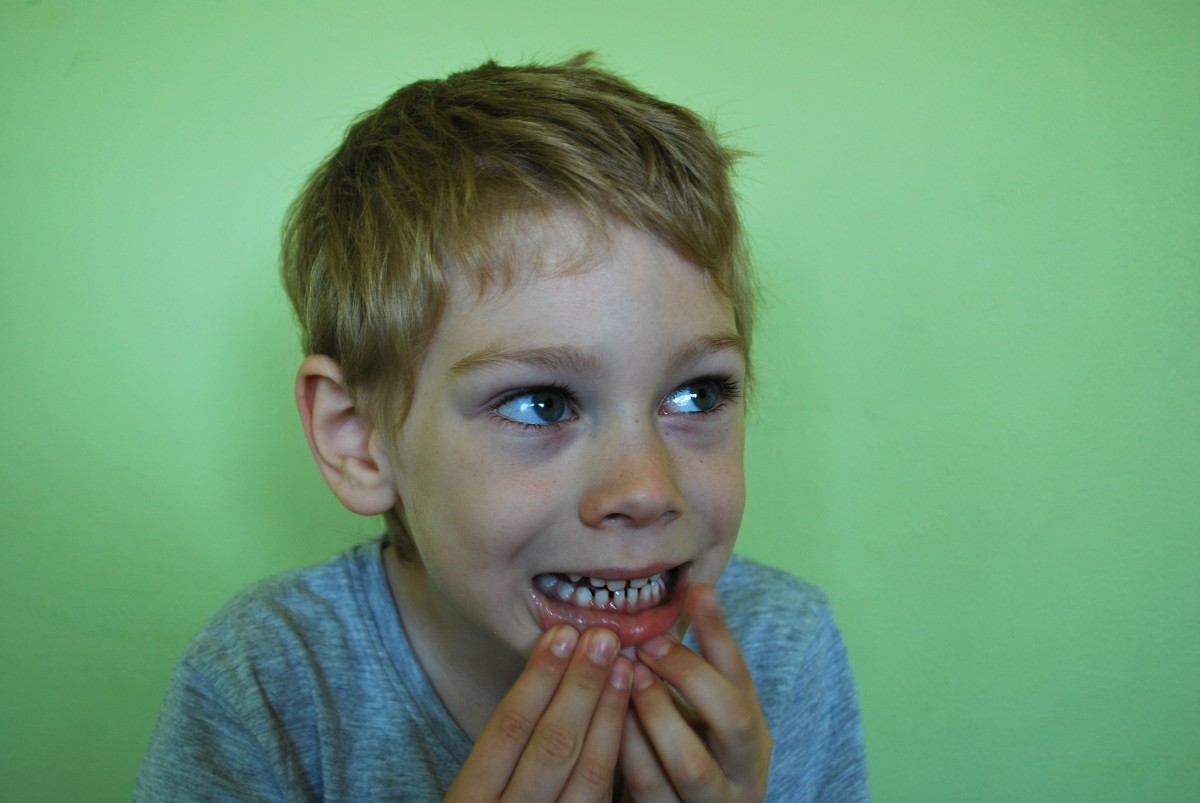 kid moving lower lip to look at baby teeth