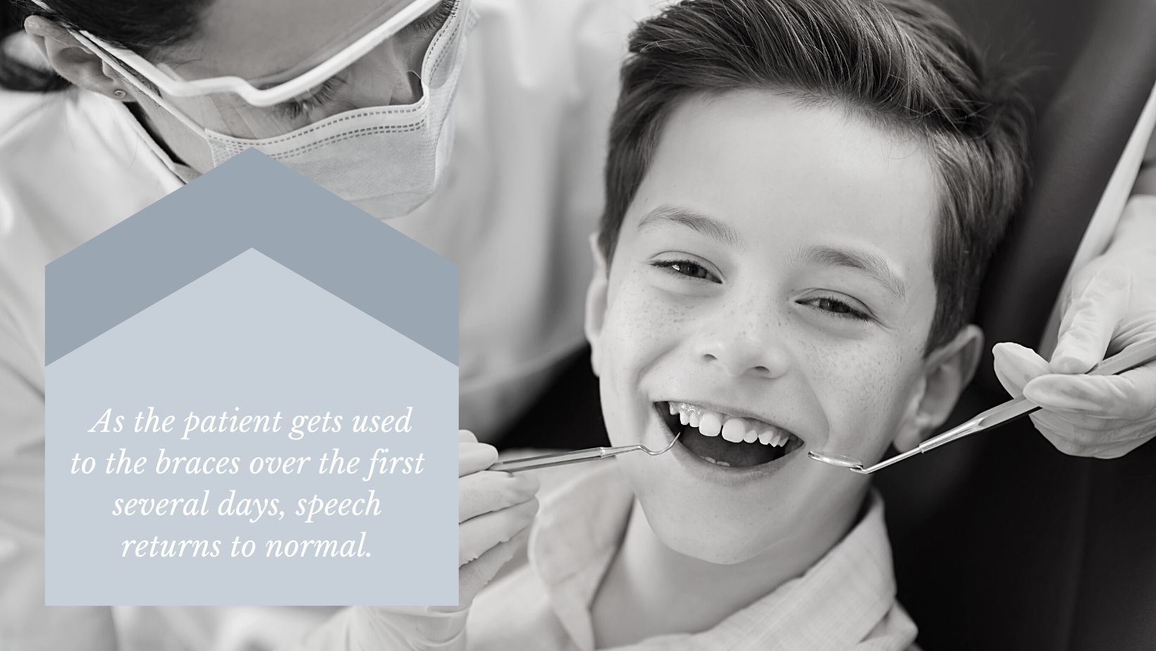 can lingual braces affect speech?