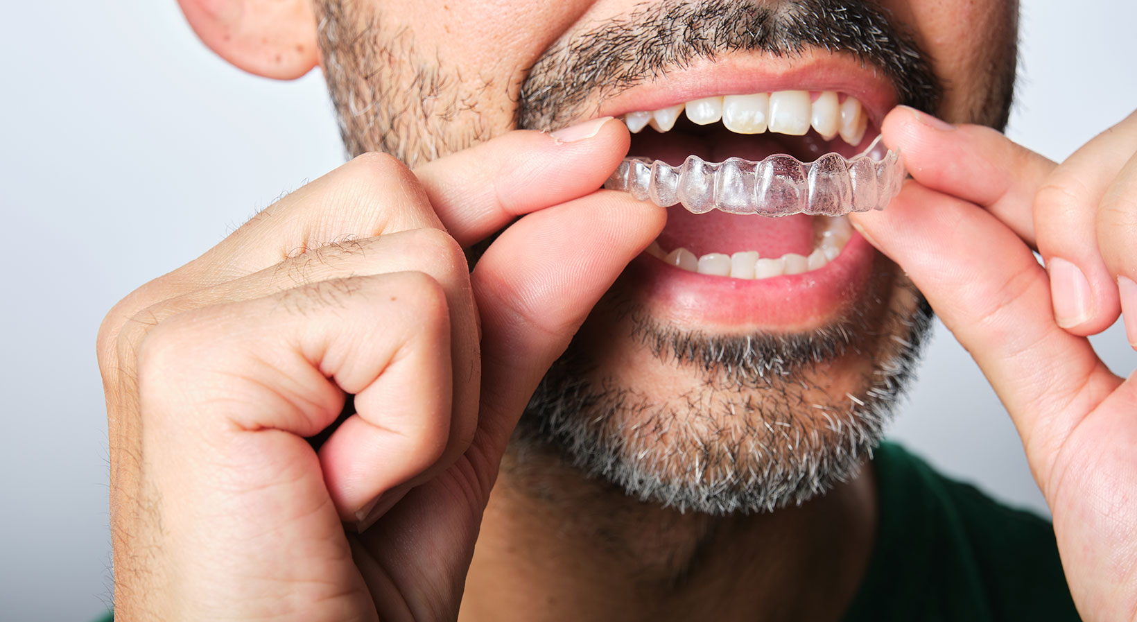 Why Does My Invisalign Hurt?