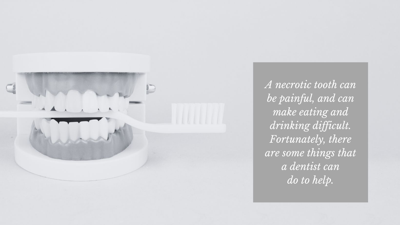 model of teeth reminder to brush teeth