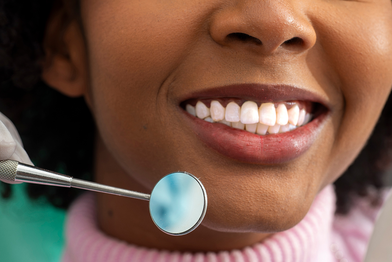 What Is Enamel Shaping and What Can It Fix?