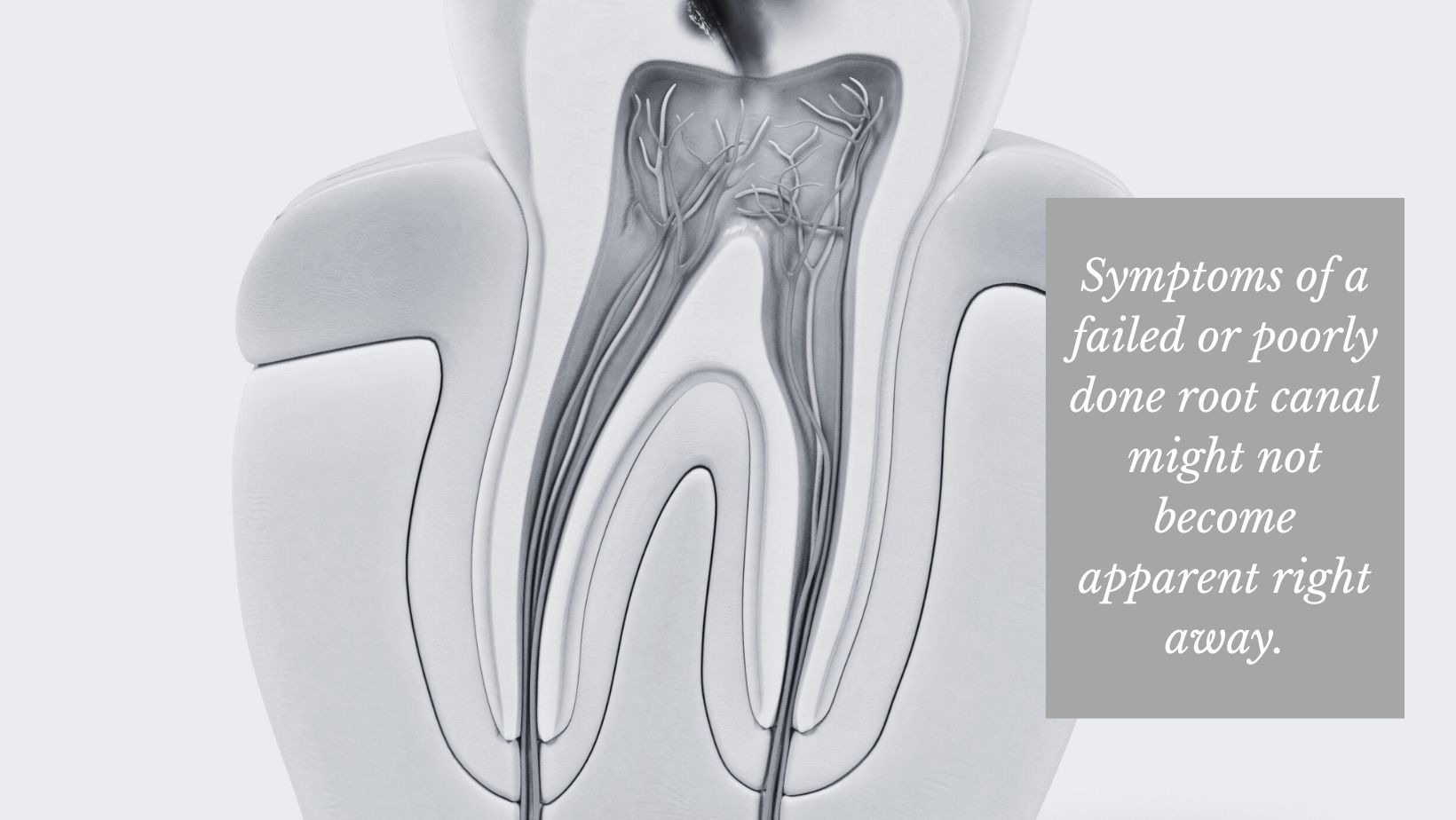 image of root of tooth