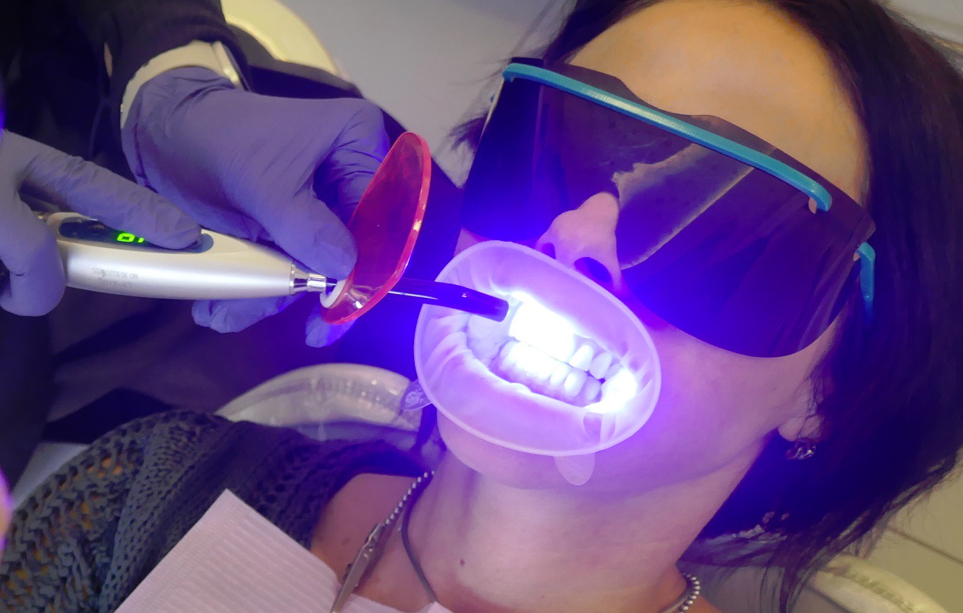 Woman getting teeth whitening procedure done at cosmetic dentist or a salon