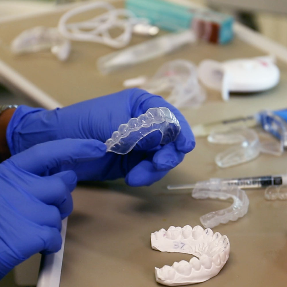 Dentist preparing carbamide peroxide teeth whitening trays