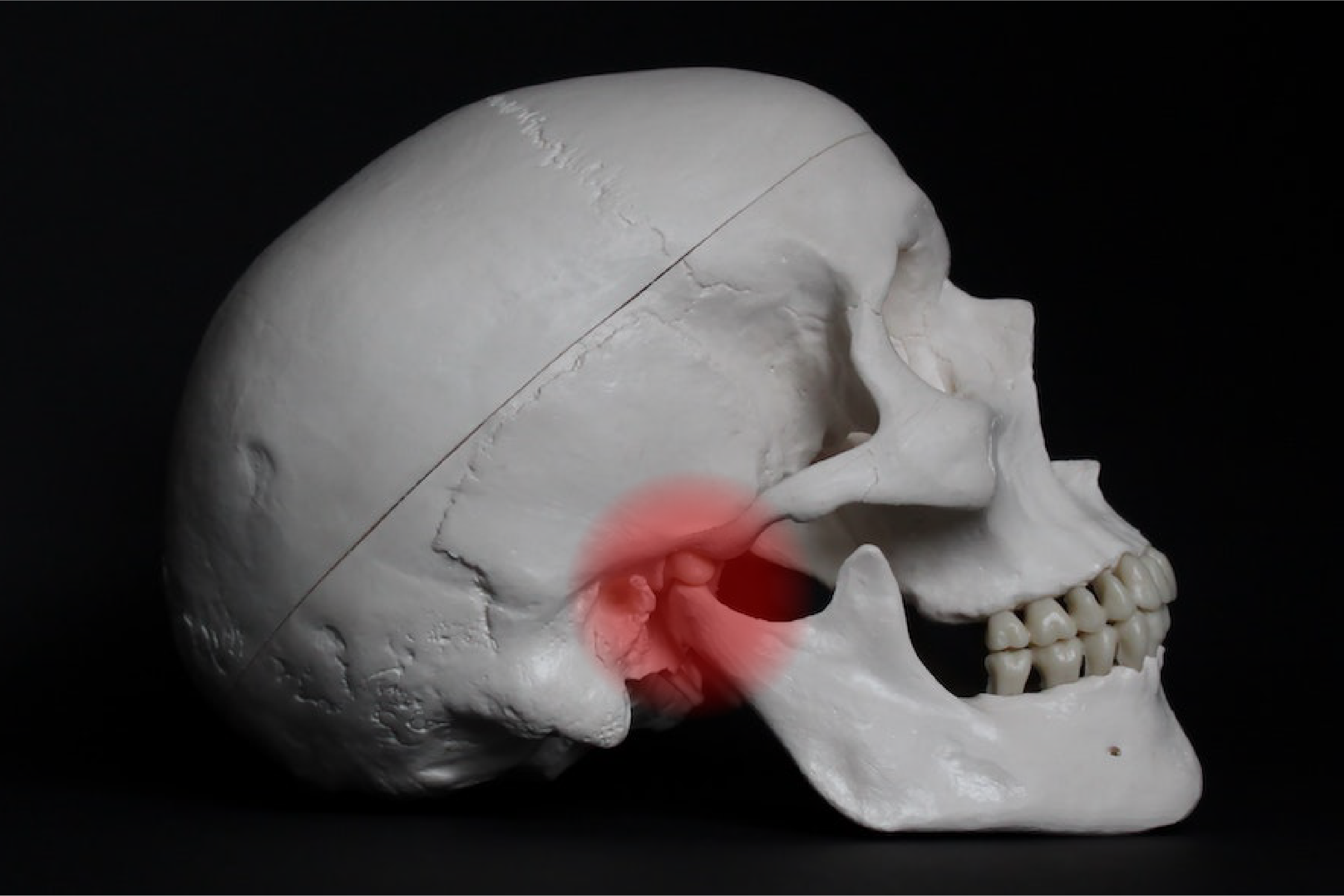 Model of a human skull with the TMJ highlighted, which can cause tooth pain