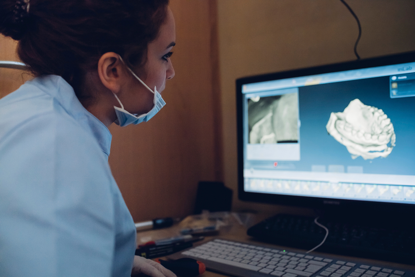 Why Do I Need a 3D Dental Scan Before an Implant, Invisalign, or Oral Surgery?